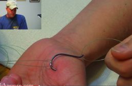 5 Ways To Remove A Fish Hook Buried Deeply In Your Skin